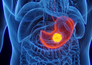 Fighting for Equity in Stomach Cancer: A Daughter’s Journey to Advocacy