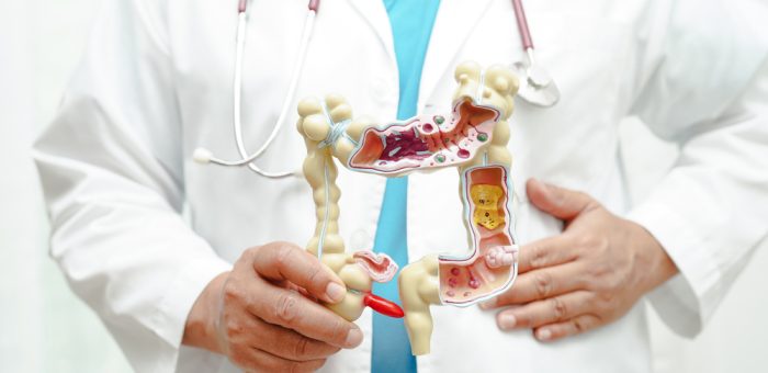 Intestine, doctor holding anatomy model for study diagnosis and